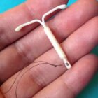 Cara Pemasangan KB IUD dan Fakta Penting yang Wajib Diketahui Pasien