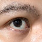 Cara Mengobati Mata Silinder, Panduan Lengkap Penanganan yang Efektif