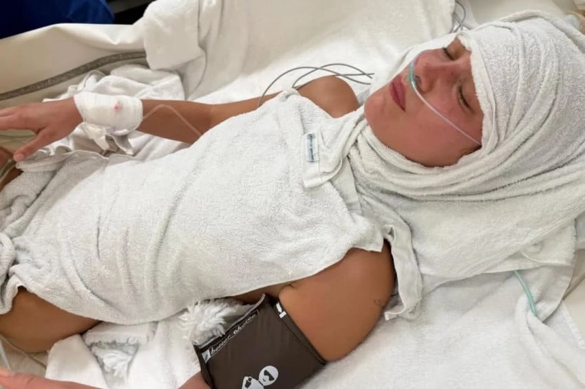 12 Artis Hollywood Mengidap Penyakit Lyme, Kondisi Bella Hadid Mengkhawatirkan