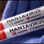 Ahli Epidemiologi Sebut Lingkungan Terbuka Lebih Aman dari Penularan Hantavirus