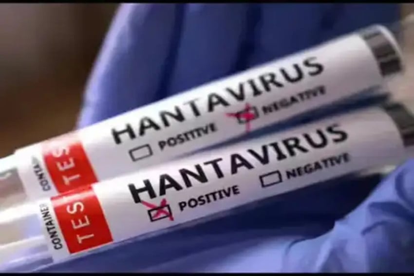 Ahli Epidemiologi Sebut Lingkungan Terbuka Lebih Aman dari Penularan Hantavirus